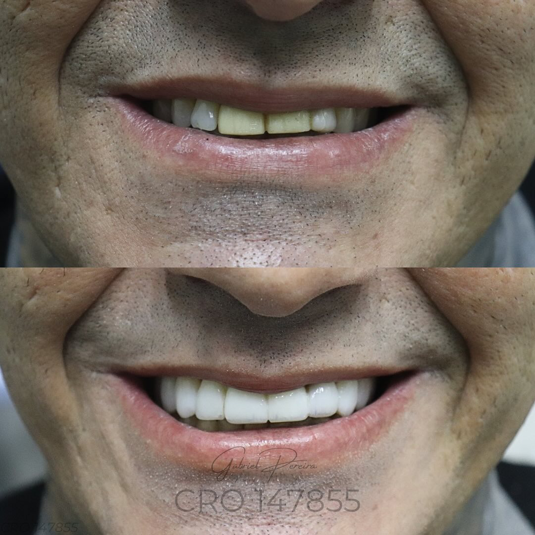 Prancheta 1 copiar 7